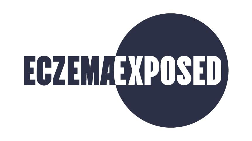 Eczema Exposed logo featuring a dark navy-blue circle with the words 'ECZEMA' in bold sans-serif font and 'EXPOSED' in a condensed modern sans-serif font, both in white uppercase letters on a white background.