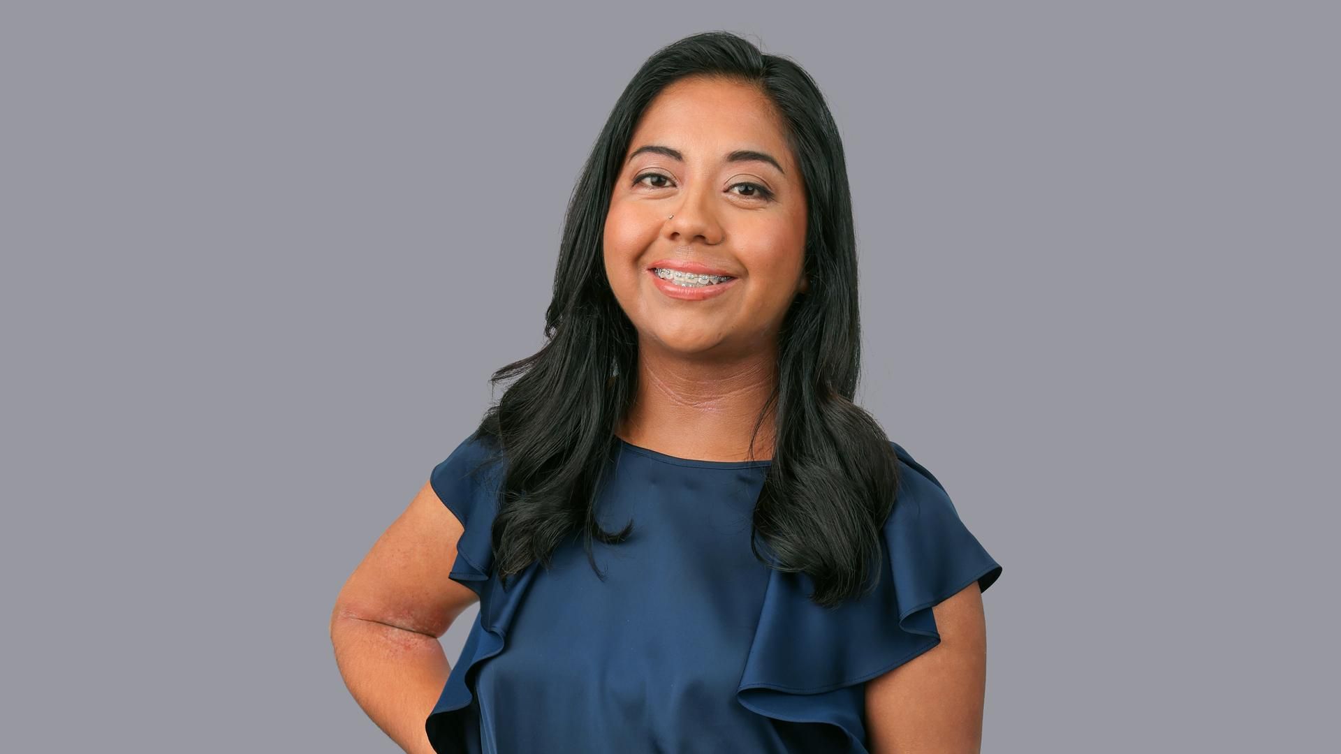 Cristal, a chronic eczema patient, wears a blue shirt and smiles at the camera against a grey background.