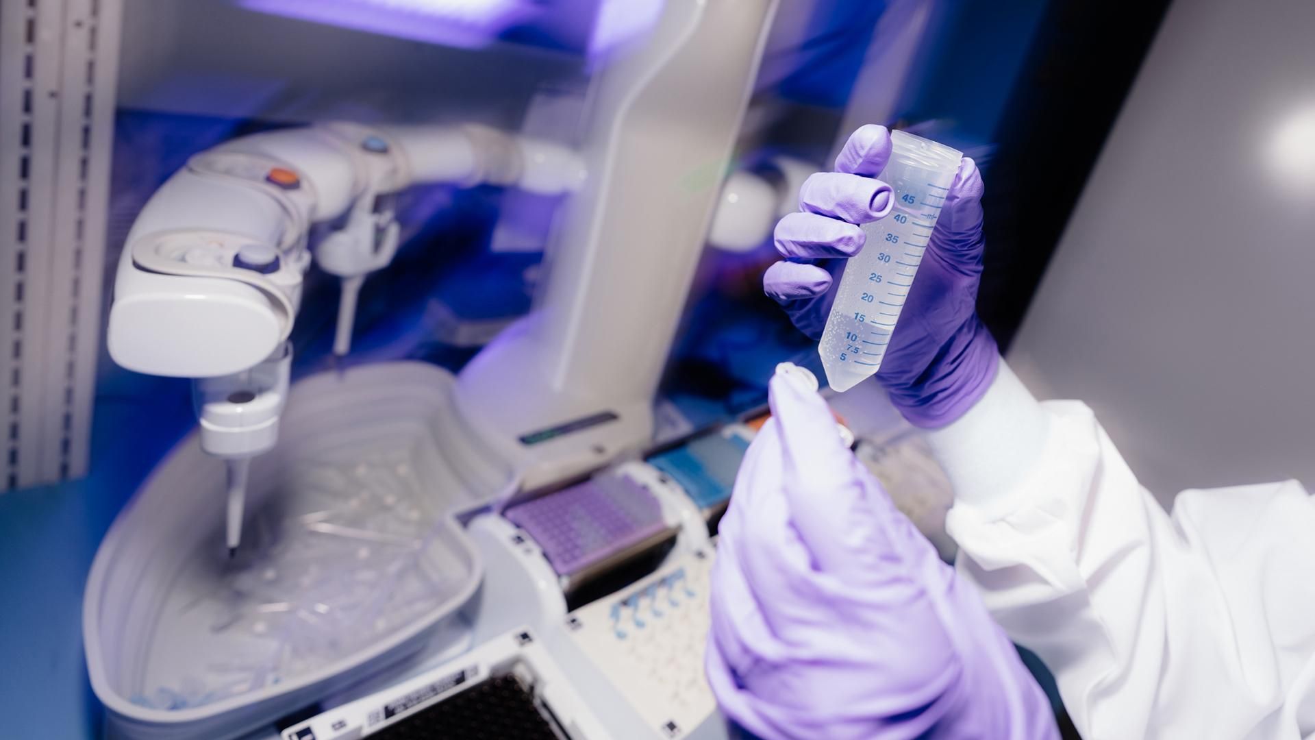 Hand holding a liquid sample, preparing for mass spectrometry analysis.
